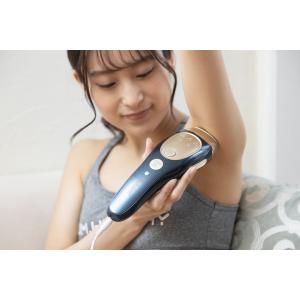 【シングル】Remozer|リムーザー 脱毛 ...の詳細画像2