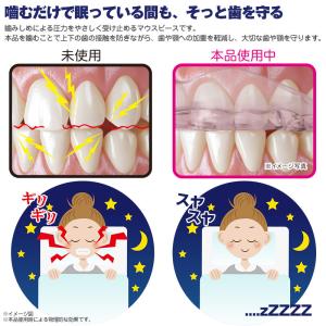 歯ぎしり 睡眠時マウスピース 形状記憶 Dr....の詳細画像2