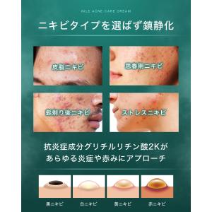 NILE ニキビクリーム ニキビケア メンズ ...の詳細画像3