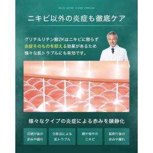 NILE ニキビクリーム ニキビケア メンズ ...の詳細画像4
