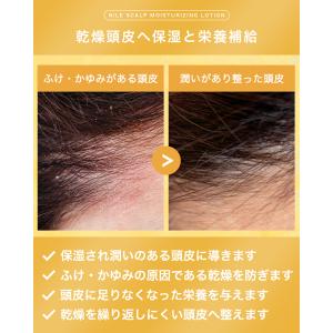 NILE 頭皮保湿ローション 頭皮用化粧水 本...の詳細画像3