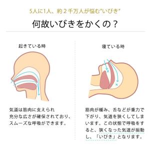 無呼吸症候群 対策 グッズ いびき 治し方 い...の詳細画像3