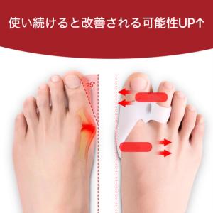 外反母趾 サポーター 左右兼用 外反母趾グッズ...の詳細画像2