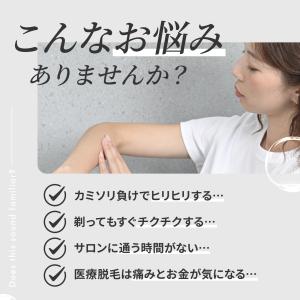 除毛器 擦るだけ 除毛パッド くるくるこするだ...の詳細画像2