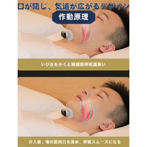 いびき対策グッズ いびき改善 いびき防止 無呼...の詳細画像4