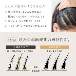 イオン電気針ヘッドスパ 頭皮 ヘッドマッサージ...の詳細画像2