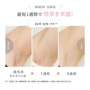 脱毛器 MYTREX 公式 MiRAY AIR...の詳細画像5