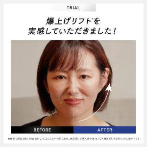 「30日間返品保証」美顔器 EMS MYTRE...の詳細画像3