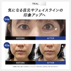 「30日間返品保証」美顔器 EMS MYTRE...の詳細画像4