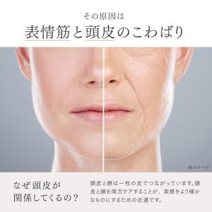 ポスポス 美顔器 MYTREX REBIVE ...の詳細画像5