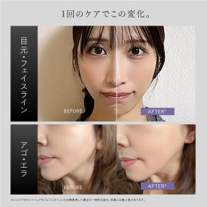 MYTREX SHAPE POINTER マイ...の詳細画像3