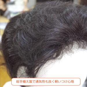 部分ウィッグ ミセス top-dv Lサイズ ...の詳細画像2