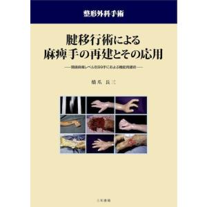 腱移行術による麻痺手の再建とその応用