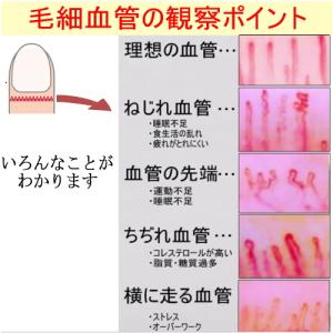 Jスコープ 血流スコープMJ-BL10 ゴース...の詳細画像3