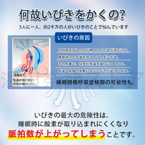 いびき防止 グッズ 無呼吸症候群 いびき対策グ...の詳細画像2