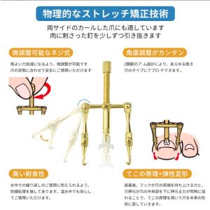 まきづめ 矯正器具 1つの軸穴×5種類パーツ ...の詳細画像3