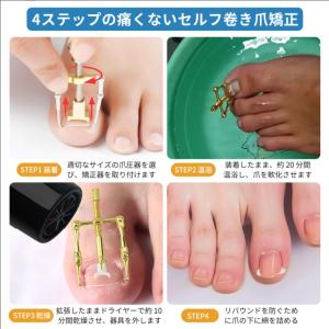 まきづめ 矯正器具 1つの軸穴×5種類パーツ ...の詳細画像4