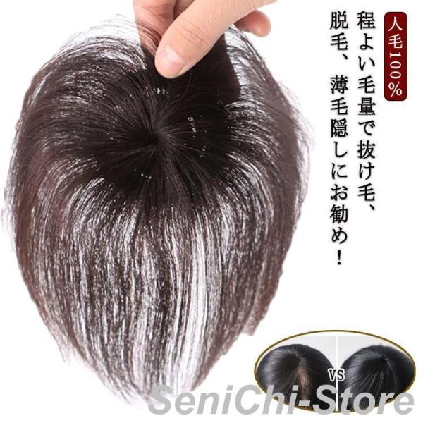 円形脱毛症 人毛100% 部分ウィッグ トップカバー メンズ レディース つむじ 隠し 頭頂部 ショ...
