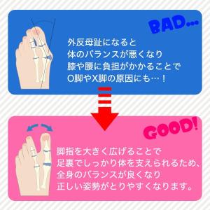足指サポーター 外反母趾 矯正 サポーター 2...の詳細画像1