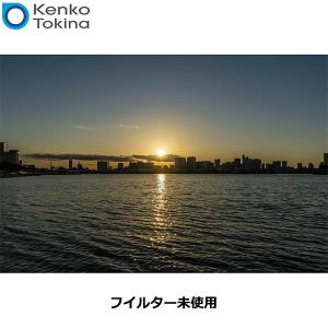 ケンコー・トキナー 82S Kenko ノスタ...の詳細画像2