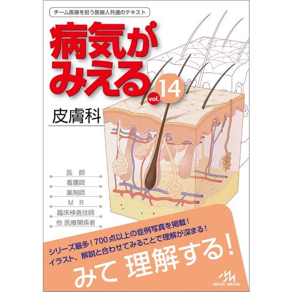 病気がみえるvol．14 皮膚科 ／ メディックメディア