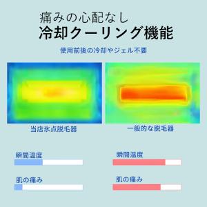 脱毛器 IPL光脱毛器 冷感脱毛器 90万発照...の詳細画像5