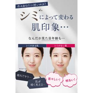 オールインワンジェル 薬用美白ケア パーフェク...の詳細画像5