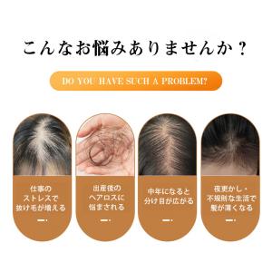 美顔器 電気ブラシ EMS 目元 頭皮 電気針...の詳細画像2