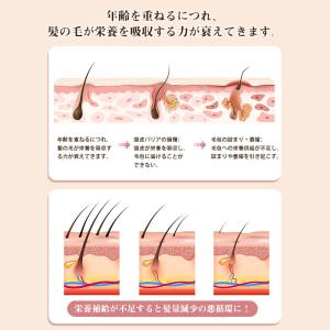 美顔器 電気ブラシ EMS 目元 頭皮 電気針...の詳細画像3
