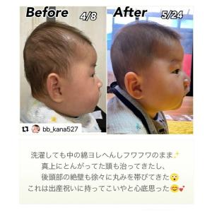 エスメラルダ 新生児 ドーナツ枕 2個セット ...の詳細画像3