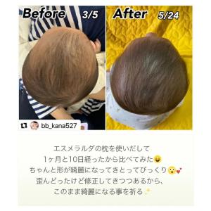 エスメラルダ 新生児 ドーナツ枕 2個セット ...の詳細画像2