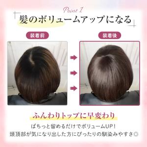 部分ウィッグ カツラ トップピース 女性 つむ...の詳細画像4