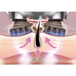 ゾーガンキンスカルプ EMS ヘッドスパ 頭皮...の詳細画像3