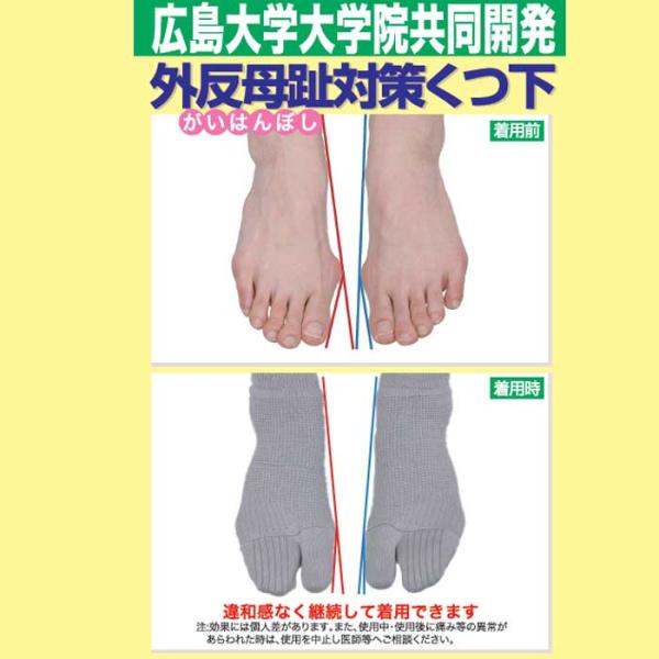 外反母趾対策靴下　外反母趾 靴下 広島大学共同開発 外反母趾対策ソックス レディース メンズ 矯正 ...