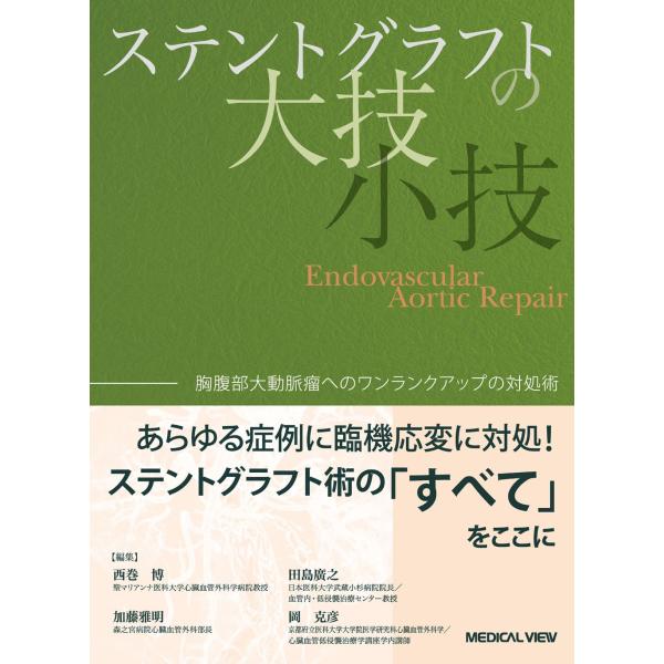 ステントグラフトの大技・小技?胸腹部大動脈瘤へのワンランクアップの対処(中古品)