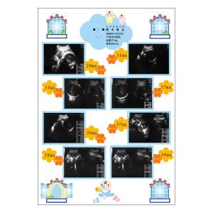 エコー写真 保存の商品一覧 通販 Yahoo ショッピング