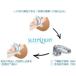 いびき対策 マウスピース スリープタイト ST...の詳細画像2