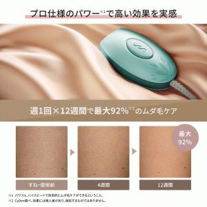 脱毛器 光美容器 全身脱毛 VIO対応 ヒゲ ...の詳細画像2