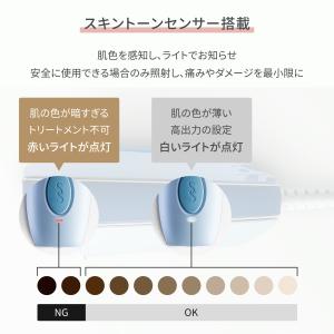 脱毛器 光美容器 全身脱毛 VIO対応 ヒゲ ...の詳細画像5