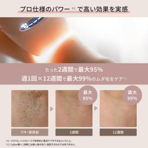 脱毛器 光美容器 全身脱毛 VIO対応 ヒゲ ...の詳細画像4