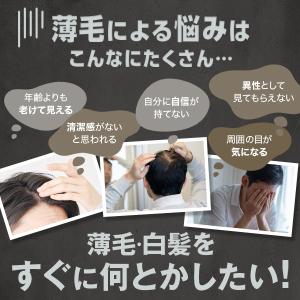 白髪隠し 薄毛隠し 増毛スプレー 公式 チャッ...の詳細画像2
