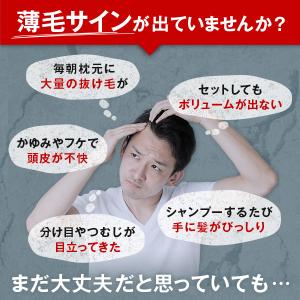 公式 チャップアップ 医薬部外品 育毛剤 1本...の詳細画像5