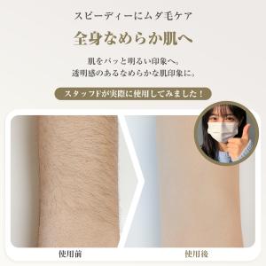 【2,180円→1,750円4時間特売】脱毛器...の詳細画像5