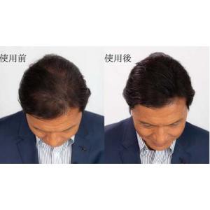スーパーミリオンヘアー ダークブラウン ( 3...の詳細画像4