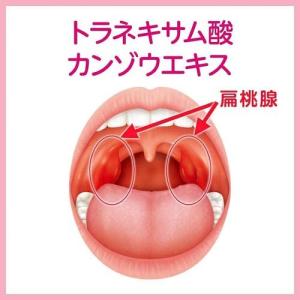(第3類医薬品)ハレナース ( 18包 )/ ...の詳細画像3