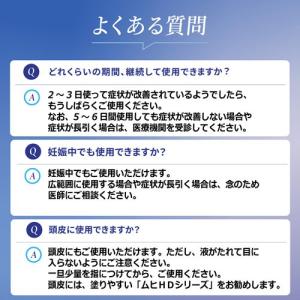 (第(2)類医薬品)ムヒベタV液 ( 10g(...の詳細画像5