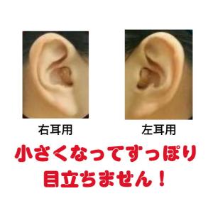 デジミミ3 超小型耳穴型デジタル補聴器 左耳用の詳細画像2