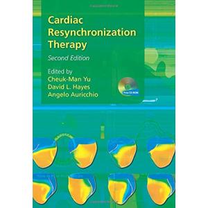 Cardiac Resynchronization Therapy 並行輸入