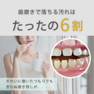 歯石取り 家庭用歯石取りセット 口腔洗浄器 超...の詳細画像1