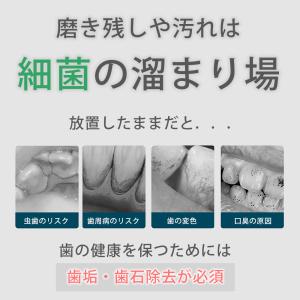 歯石取り 家庭用歯石取りセット 口腔洗浄器 超...の詳細画像2